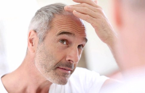 خرید و فروش لیزر دایود و الکساندرایت توصیه های جهت ریزش مو و روشی برای درمان بشناسیم