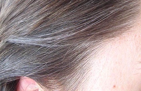 خرید و فروش لیزر دایود و الکساندرایت نکاتی در خصوص جلوگیری از سفید شدن مو بیاموزیم
