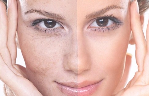 خرید و فروش لیزر دایود و الکساندرایت بهترین روش های جلوگیری از خشکی پوست چیست