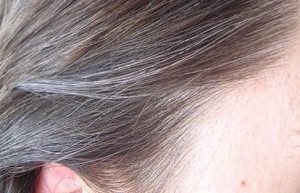 خرید و فروش لیزر دایود و الکساندرایت نکاتی در خصوص جلوگیری از سفید شدن مو بیاموزیم